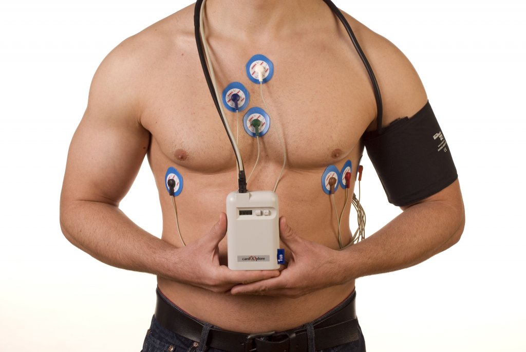 Пациент стоит с подключенным к нему аппаратом для проведения ЭКГ