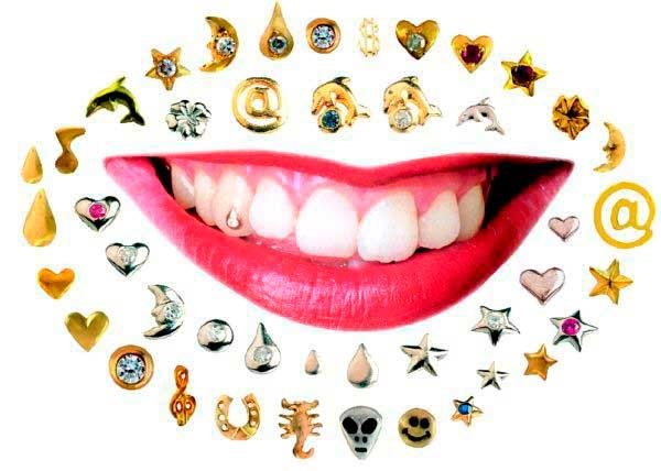 Декоративные украшения на зубы