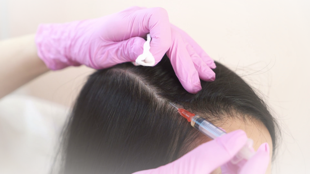 Процесс проведения мезотерапии кожи головы 